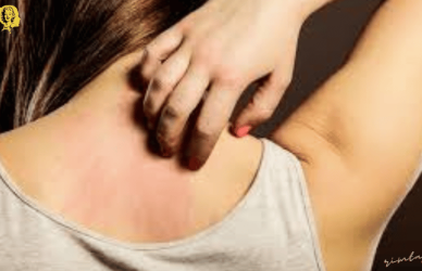 علاج حكة الوجه واحمراره,علاج الوردية في الوجه,علاج حساسية الوجه بالعسل,علاج حساسية الوجه من الشمس,علاج حساسية الوجه المفاجئه,علاج حكة الوجه بالاعشاب,علاج احمرار الوجه,علاج احمرار الوجه بعد التقشير,علاج الحكة,حساسية الوجه,حساسية الوجه عند الاطفال,الوردية في الوجه,اسباب حساسية الوجه المفاجئه,أسباب حساسية الوجه,حساسية الانف عند الاطفال و علاجها,الحساسية في الوجه,كريم لحساسية الوجه,احمرار الوجه,حمو النيل عند الرضع و علاجه,علاج حساسية الجلد والحكة،حساسية الوجه،حكة الوجه واحمراره، تهيج الوجه،
