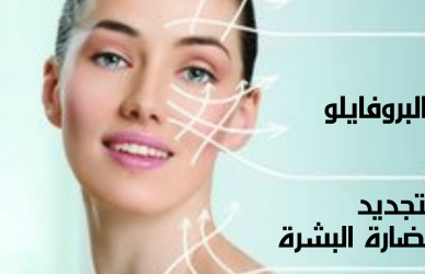 أبرة النضارة