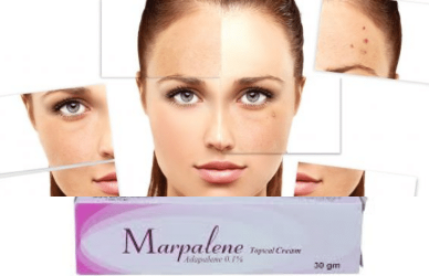 كريم ماربالين,كريم ماربلين,ماربالين كريم,ماربالين,كريم ماربالين marpalene لعلاج البثور وحب الشباب,كريم مربالين,كريم ماربالين مقشر للوجه,كريم ماربالين لازاله حب الشباب,ماربلين,اضرار استعمال كريم ماربلين,كريم ماربلين للتقشير و علاج حب الشباب,كريم مربلين للحبوب,كريم مربلين مقشر للوجه,حد جرب كريم ماربالين,كريم ماربالين للبقع,ماربالين كريم للوجه,سعر كريم ماربالين في مصر,كريم ماربالين لاثار الحبوب,كريم لعلاج حب الشباب,ماربلين للتقشير,مربالين